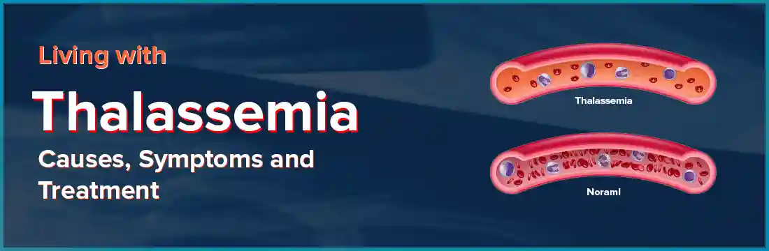 Thalassemia Treatment in India
